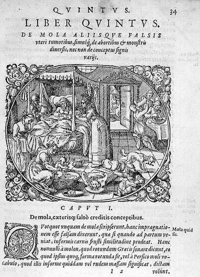 Dopo la nascita, illustrazione dal capitolo 1, Libro 5 di 