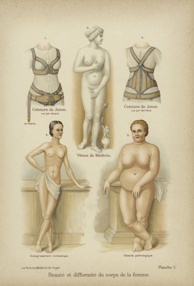 Bellezza e deformità nel corpo femminile da German School