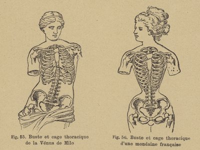 Confronto della forma del petto e della gabbia toracica della Venere di Milo con quella di una socialite francese di fine XIX secolo da German School