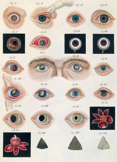 Descrizione delle anomalie congenite dell