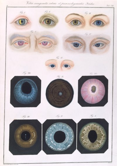 Descrizione delle anomalie congenite dell