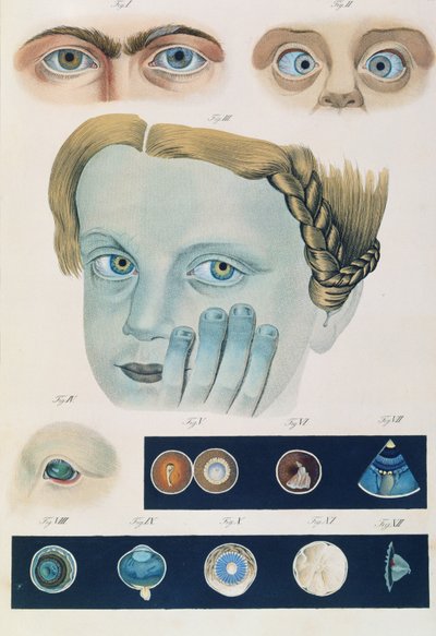 Descrizione delle anomalie congenite dell
