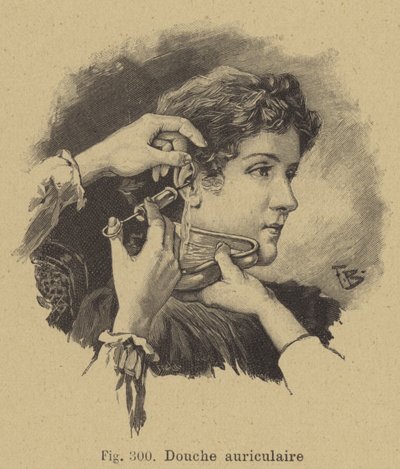 Irrigazione dell