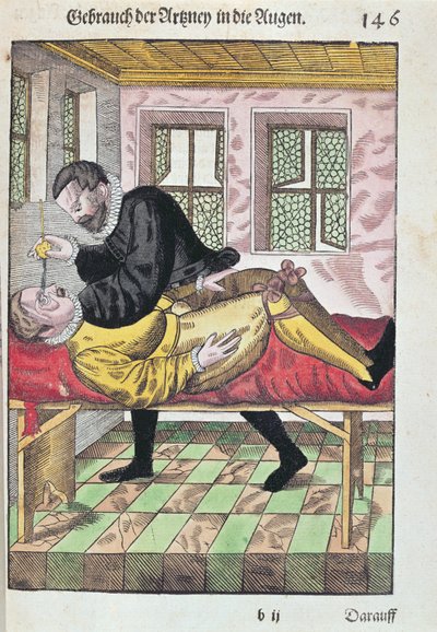 Operazione agli occhi, da Ophthalmodouleia di Georg Bartisch (1535-1636) pubblicato a Dresda nel 1583 da German School