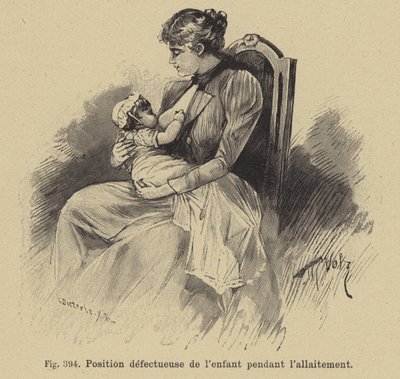 Posizione scorretta di un bambino durante l