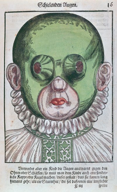 Maschera per il trattamento di uno strabismo, da Ophthalmodouleia di Georg Bartisch (1535-1636) pubblicato a Dresda nel 1583 da German School