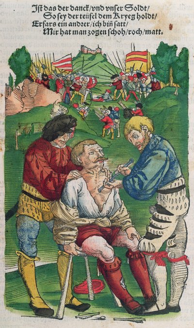 Rimozione di una freccia, illustrazione da Feldtbuch der Wundartzney di Hans von Gersdorff, 1540 da German School