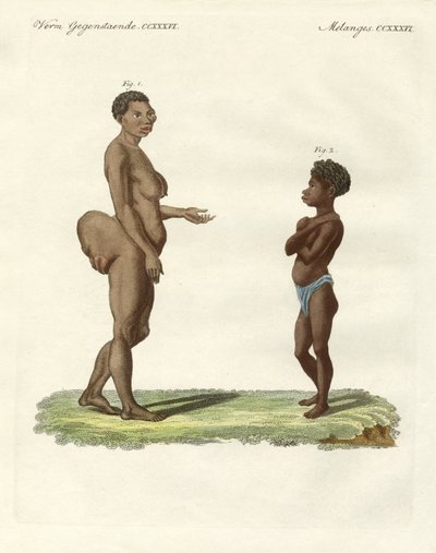 Strane varietà umane da German School