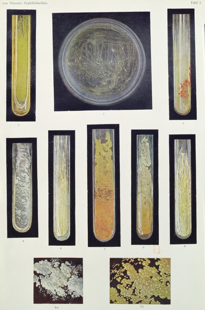 Bacillo della sifilide, da un libro di Max von Niessen, Lipsia, 1908 da German School