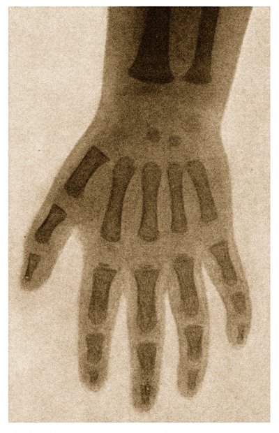 Radiografia della mano di un bambino c.1890 da German School