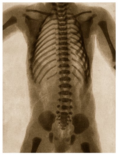 Radiografia di un torso umano c.1890 da German School