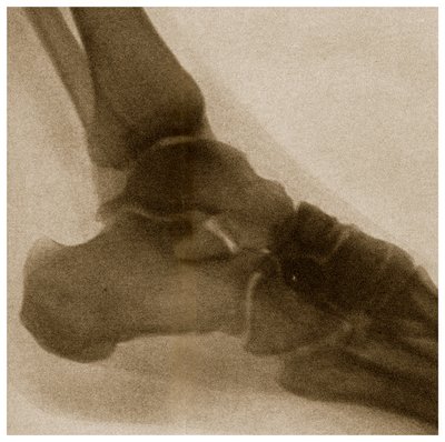 Radiografia di una caviglia c.1890 da German School