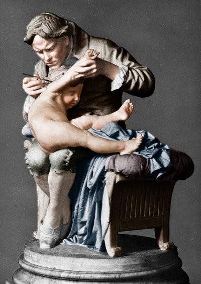 Edward Jenner, medico inglese, vaccina suo figlio, c1796 da Giulio Monteverde