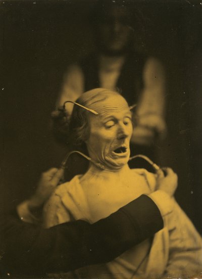 Espressione di terrore, 1854-1856, stampato nel 1862 (foto) da Guillaume-Benjamin-Armand Duchenne de Boulogne
