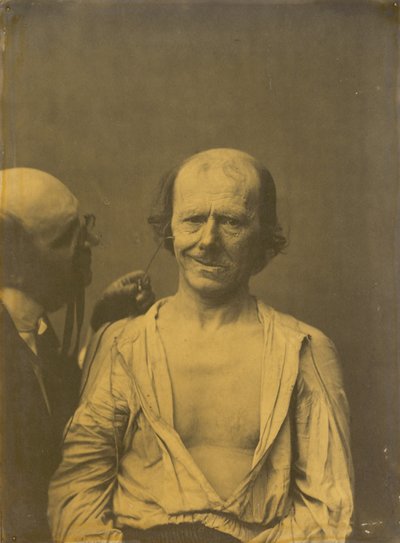 Un volto rilassato (sinistra); Falsa gioia o risata (destra) da Guillaume Benjamin Amant Duchenne