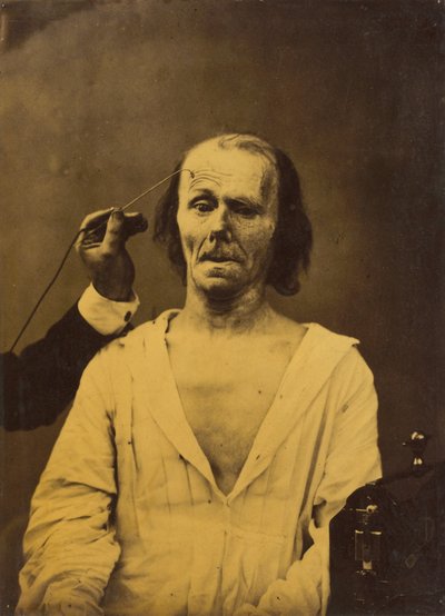 Un volto rilassato (sinistra); Attenzione profonda (destra) da Guillaume Benjamin Amant Duchenne