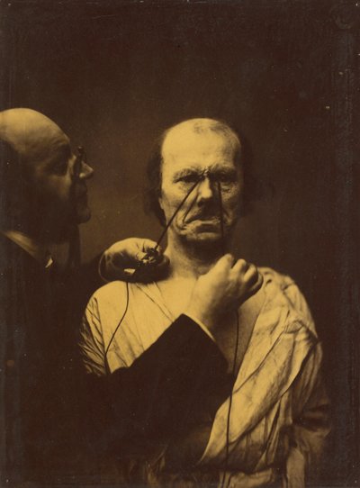 Aggressione, malvagità da Guillaume Benjamin Amant Duchenne