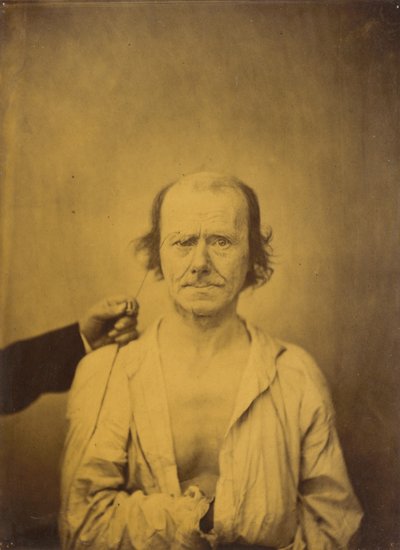 Attenzione (sinistra); Riflesso (destra) da Guillaume Benjamin Amant Duchenne