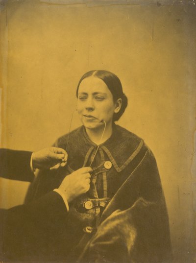 Disgusto sprezzante (sinistra); Risata sprezzante (destra) da Guillaume Benjamin Amant Duchenne