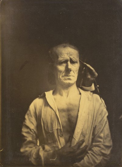 Spasmo del m. corrugator supercilii sotto luce molto forte (sinistra); Un volto rilassato (fotografato in pieno sole) (destra) da Guillaume Benjamin Amant Duchenne