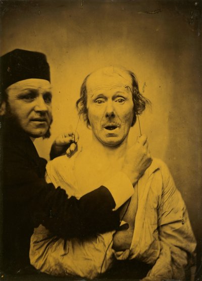 Sorpresa da Guillaume Benjamin Amant Duchenne