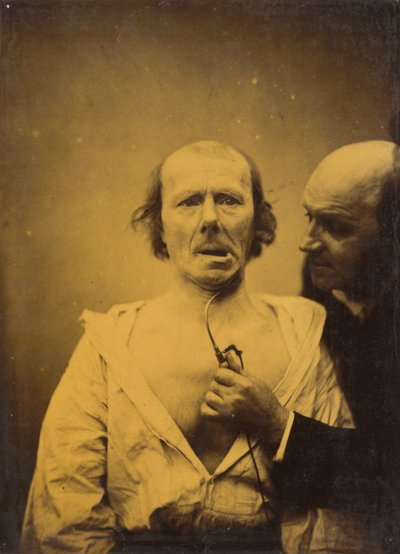Questa contrazione del m. platysma da sola manca di espressione da Guillaume Benjamin Amant Duchenne