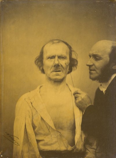 Pianto, lacrime di pietà (sinistra); Viso rilassato (destra) da Guillaume Benjamin Amant Duchenne
