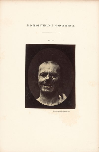 Elettrofisiologia fotografica, Figura 53 da Guillaume Benjamin Duchenne
