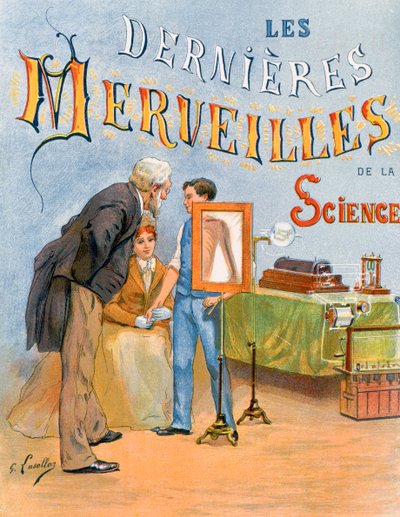 Esame del braccio di un bambino tramite radiografia da Gustave Francois Lasellaz