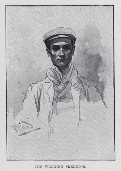 Lo scheletro ambulante (foto in b/n) da Harold Hume Piffard