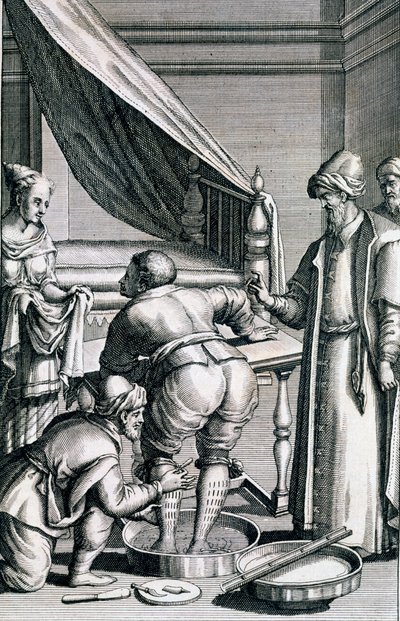Salasso nelle gambe, da Medicina Aegyptiorum di Prospero Alpini, pubblicato 1745 da Italian School