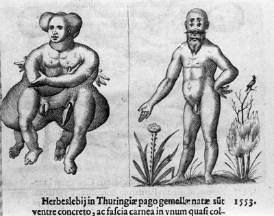 Diversi tipi di mostri umani. Incisione da “De monstrorum natura, causis et differentiis” di Fortunio Liceti (1577-1656), scienziato italiano. 1646 da Italian School