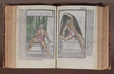 Anatomia femminile, da Commentaria cum amplissimis additionibus super anatomiam mundini, di Jacopo Berengario da Carpi (c.1460-c.1530) pubblicato a Bologna, 1521 (xilografia a colori) da Italian School