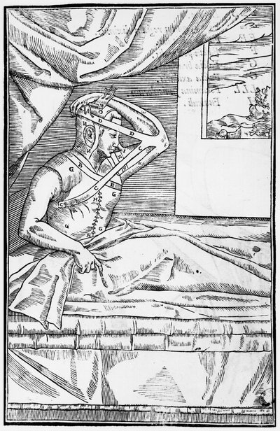 Chirurgia ricostruttiva del naso, illustrazione da De curtorum chirurgia per insitionem di Gaspare Tagliacozzi (1545-99) Venezia, pubblicato nel 1597 da Italian School