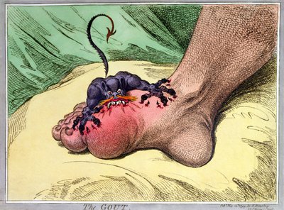 La gotta, pubblicato da Hannah Humphrey nel 1799 da James Gillray