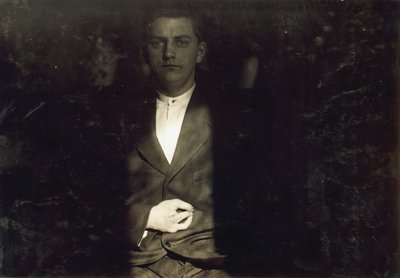 Frank Wiegel di Brooklyn, ferito dopo aver lavorato 18 ore al giorno a 15 anni, gli sono state amputate due dita della mano destra, New York City da Lewis Wickes Hine
