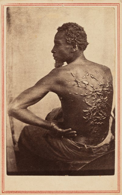 La schiena flagellata, c. 1863 (foto) da McPherson & Oliver