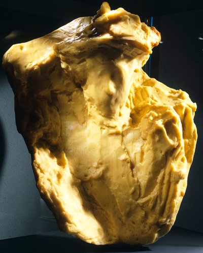 Il bookmaker da Medardo Rosso