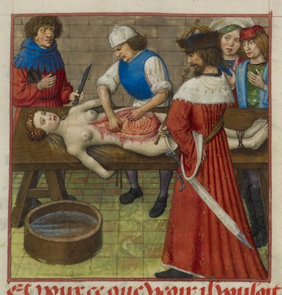 Nerone che osserva mentre sua madre Agrippina viene dissezionata, illustrazione da 