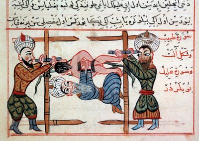 Riduzione di una frattura da Ottoman School