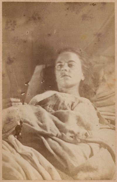 Epilepsia isterica, attacco, terzo periodo, tavola XXVI da 