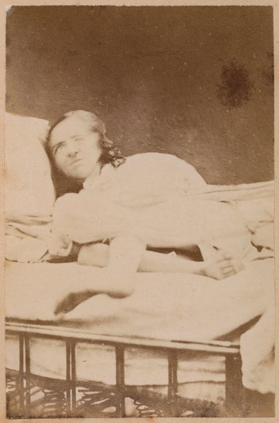 Epilessia isterica, contorsioni, tavola XXXVIII da 