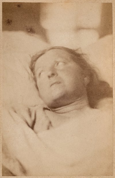 Epilepsia isterica, crocifissione, atteggiamento della testa, tavola VII da 