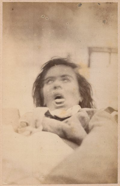 Epilepsia isterica, allucinazioni, angoscia, tavola XXIX da 