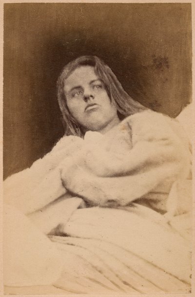 Epilepsia isterica, allucinazioni, disprezzo, tavola XXXI da 