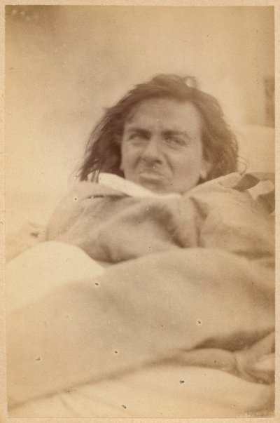 Epilepsia isterica, allucinazioni, ripugnanza, tavola XXXV da 