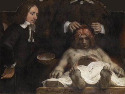 La lezione di anatomia del dottor Jan Deyman, 1656 da Rembrandt van Rijn