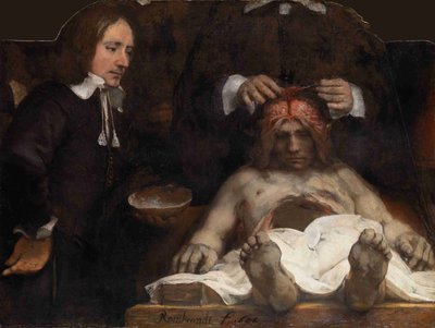 La lezione di anatomia del dottor Jan Deijman da Rembrandt van Rijn