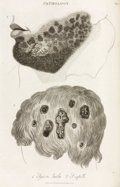 Dermatologia Malattie della pelle da John Pardon