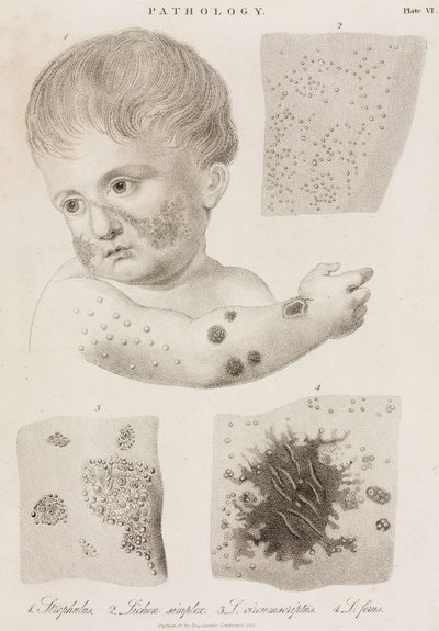 Dermatologia Tipi di malattie della pelle da John Pardon